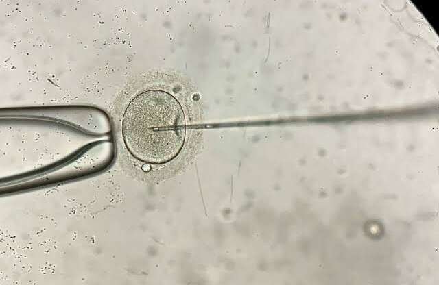 3 Day Transfers vs Blastocyst Transfers