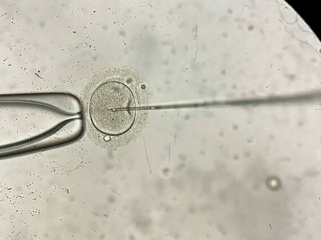 3 Day Transfers vs Blastocyst Transfers